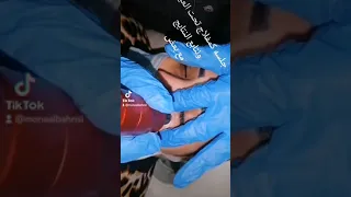 كمفلاج تحت العسن بروفشنل للاستفسار واتس ٠١١١٤٦٦١٤٤٠ دندنها