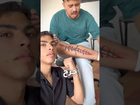 مقلب رسم جرح بالشارع العالم🍦