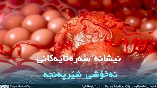 نیشانە سەرەتایەکانی نەخۆشی شێرپەنجە 