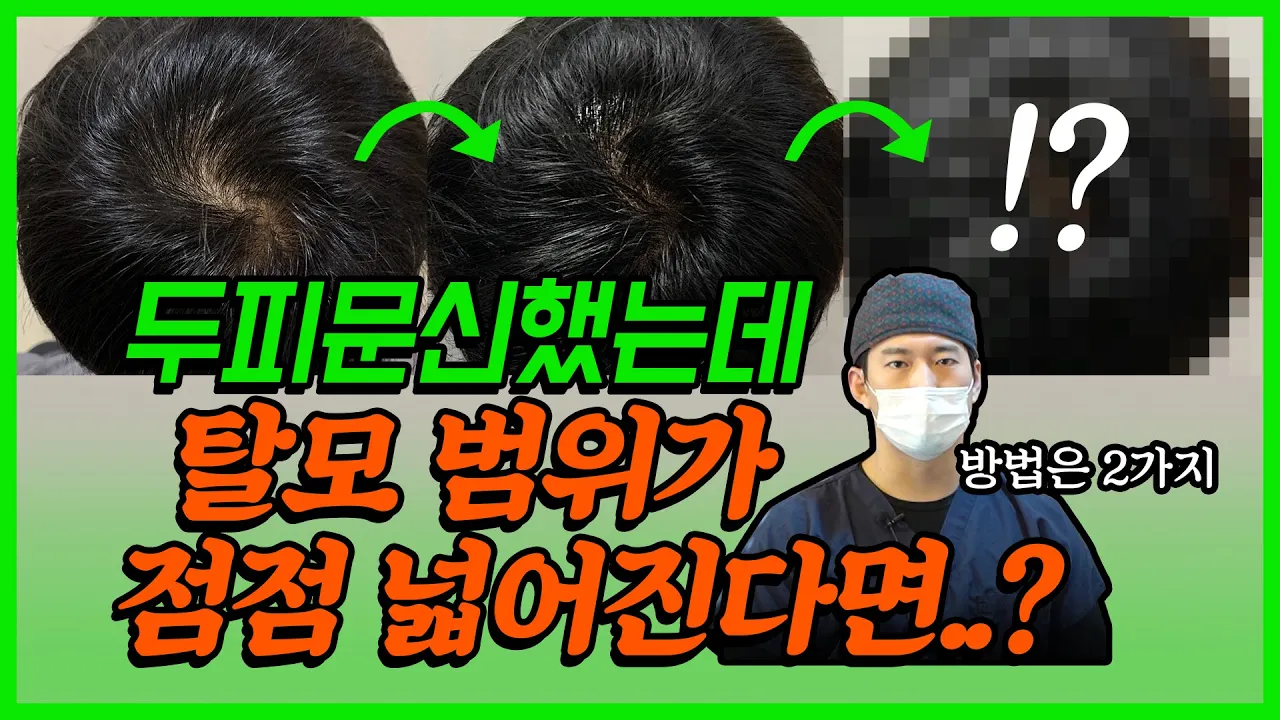 두피문신했는데 탈모 범위가 점점 넓어지면..?｜뉴헤어