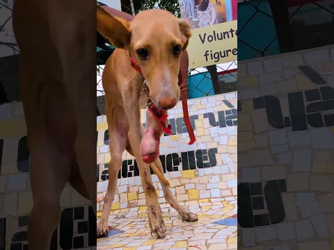 Road Accident Took His Leg, But Not His Will to Live