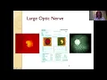 Clinical Examination of the Optic Nerve