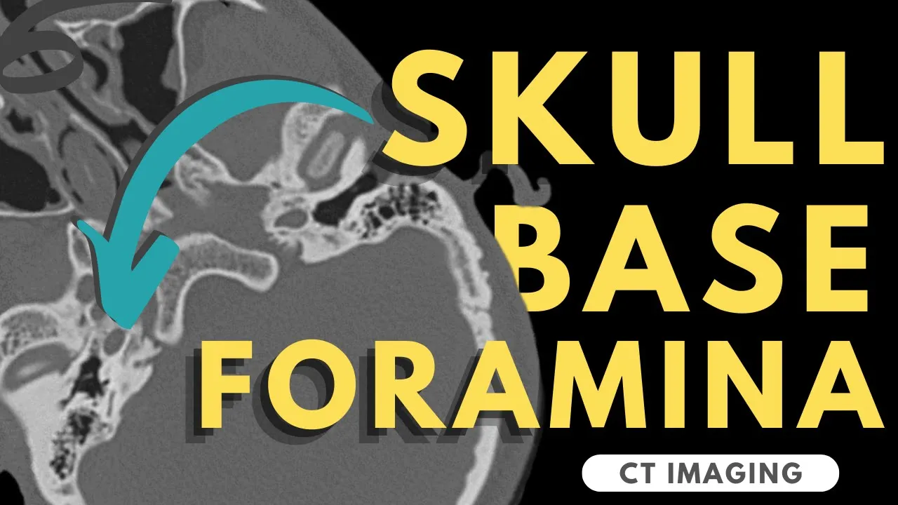 Skull Base Foramina | Radiology anatomy part 1 prep | CT imaging of skull base