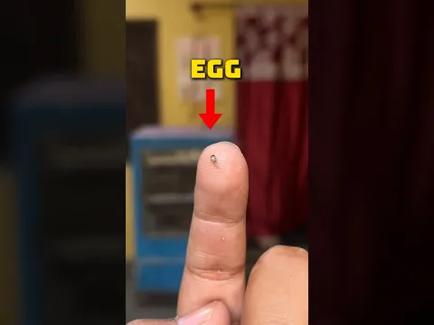 I FOUND MOSQUITO EGG (PUPAE)