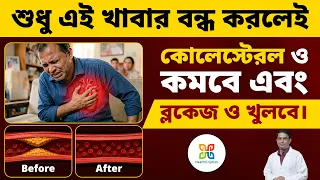 কোলেস্টেরল বেশি ? শুধু এই খাবার একবার বন্ধ করে দেখুন। Foods to Avoid to Keep Cholesterol in Check.