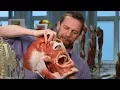 Tonsil anatomy