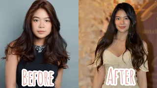 gigi de lana transformation journey rhinoplasty