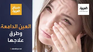 صباح العربية ما أسباب العين الدامعة وطرق العلاج  صباح العربية ما أسباب العين الدامعة وطرق العلاج