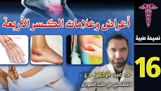 علامات الكسر الأربعة 