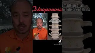 How to fix Osteoporosis SoCalChiropractic