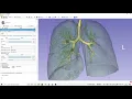 Airway segmentation in 3D Slicer with Grow from Seeds