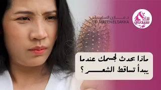 ماذا يحدث لجسمك عندما يبدأ تساقط الشعر؟