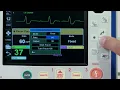 X Series Pacing English