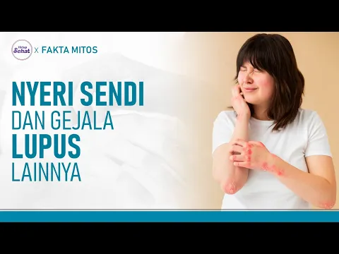 Gejala Penyakit Autoimun Lupus yang Harus Diketahui