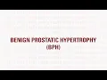 CMH Urology - Benign prostatic hypertrophy BPH symptoms and treatments