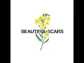 Beautiful Scars (Acoustic) - Maximillian & Moira Dela Torre