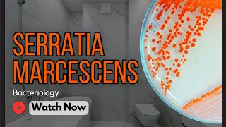 Serratia marcescens Characteristics Diseases Pathogenicity Clinical Implications Bacteriology