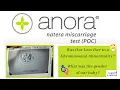 Anora Miscarriage Test by Natera Our Gender Chromosome Results