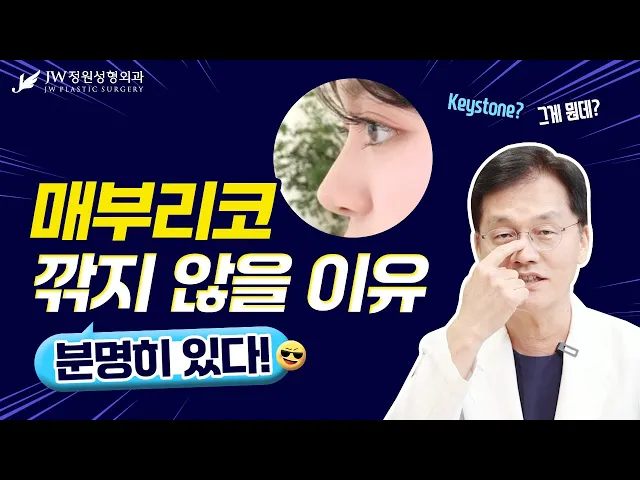 매부리코, 이제 깎지마세요! 키스톤(Keystone) 보존 매부리코 성형으로 자연스럽고 확실하게 매부리코 교정 GOGO😲😲