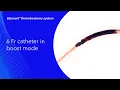 Liberant thrombectomy system 6 Fr catheter in boost mode