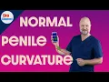 Normal penile curvature vs Peyronie s vs Chordee UroChannel