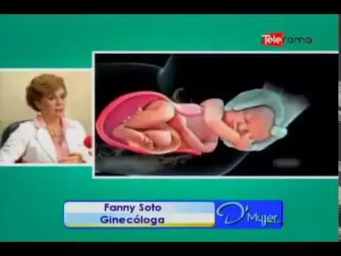 Expiden en Ecuador una guía para evitar el abuso de las cesáreas