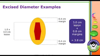 HCGTV Webinar - Tackle Your Lesion Coding Troubles