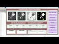 Brain Tumor Types Detection Using Image Processing IEEE Based Project Matlab Project Source Code
