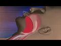 Download Lagu How sleep apnea affects your weight