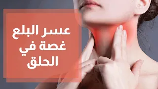 عسر البلع غصة في الحلق 