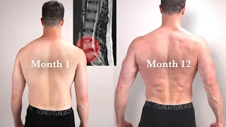 I Spent 1 Year Fixing My Lower Back Problem - I Thought Would Never Go Away