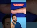 ITCHY BUMPS ON HANDS DOCTORLY