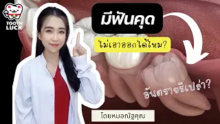  ฟันคุดคืออะไร และมีอาการอย่างไรที่บ่งชี้ว่าต้องไปพบทันตแพทย์ 