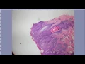 Dermpath Board review session Part 1