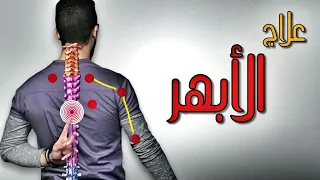 أسباب وعلاج ألم الظهر الم مابين لوحى الكتف الأبهر T4 Syndrome 