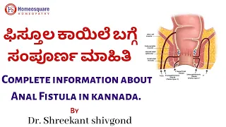 Download ಫಿಸ್ಟುಲಾ ಕಾಯಿಲೆಯ ಸಂಪೂರ್ಣ ಮಾಹಿತಿ | Complete information about Anal Fistula | Fistula treatment MP3