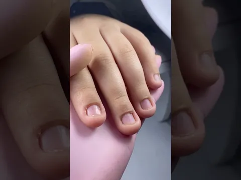 Nail Extensions on Short Nails with Extra Skin | Full Tutorial // Short Nails Transformation 💅