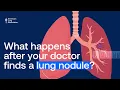 What Happens After Your Doctor Finds a Lung Nodule Pulmonary Nodule