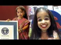 World s Smallest Woman Jyoti Amge Talks DATING and Dreams of Winning an OSCAR Exclusive
