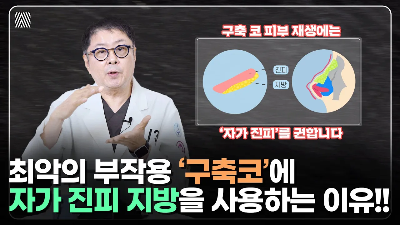 최악의 부작용 '구축코' 걱정은 이제 그만! 자가 진피 지방으로 해결하세요!  자가 진피 2편_[4월31일 성형외과]