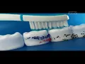 Iklan Pepsodent ''Setiap Senyuman Bergitu Berarti'' [Revisi] 15sec (2020)