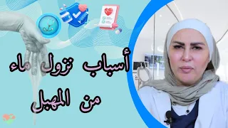 كل ما تحتاجين معرفته حول نزول الماء من المهبل الأسباب العلاج والنصائح الصحية 