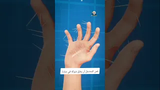 كيفية إزالة أشواك الصبار 