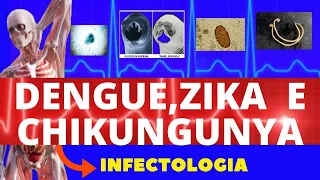 ZIKA, DENGUE E CHIKUNGUNYA - CAUSAS, SINTOMAS, DIAGNÓSTICO E TRATAMENTO - INFECTOLOGIA