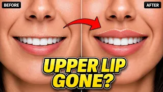 Upper Lip Disappears When You Smile? 4 Moves for a Fuller, Balanced Smile