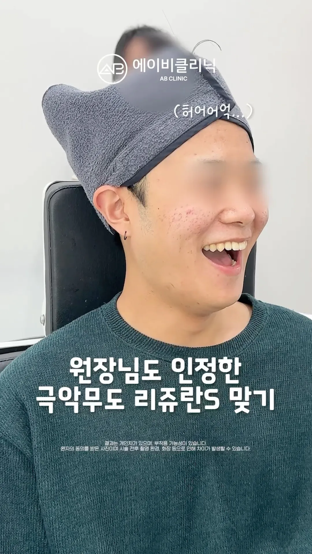 패인 흉터에 직빵인 리쥬란S 제가 받아봤습니다 🔥