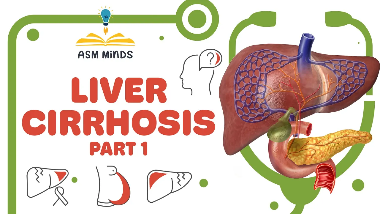 Liver cirrhosis part 1