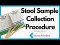 How to Collect Stool Samples for Fecal Occult Blood FOB Test