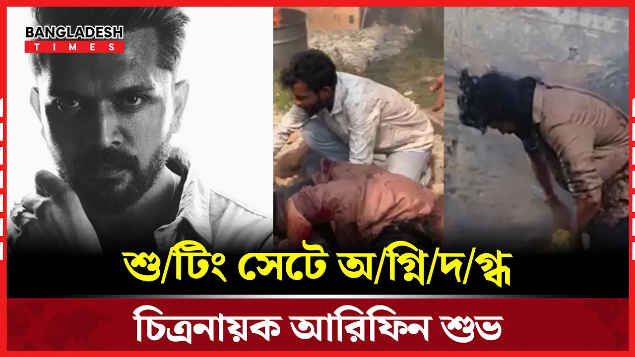 পায়ে দগ্ধ/চিহ্ন নিয়েই শুটিং চালালেন শুভ