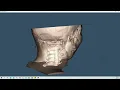 VTK Python Example - MedicalDemo2